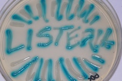 A look at the disease transmission factors associated with Listeria monocytogenes point out some unique and difficult problems that can confound our controls.