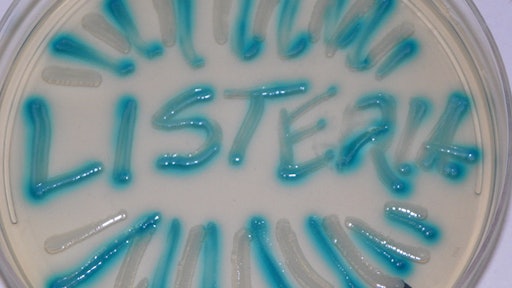 A look at the disease transmission factors associated with Listeria monocytogenes point out some unique and difficult problems that can confound our controls.