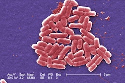 An independent review found the 2012 outbreak of E. coli O157:H7 that led to the largest beef recall in Canadian history was due to a lax approach to food safety on the part of XL Foods. The independent panel also said XL Foods was not prepared to handle a large recall.