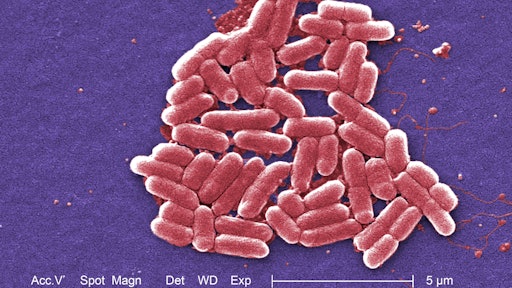An independent review found the 2012 outbreak of E. coli O157:H7 that led to the largest beef recall in Canadian history was due to a lax approach to food safety on the part of XL Foods. The independent panel also said XL Foods was not prepared to handle a large recall.