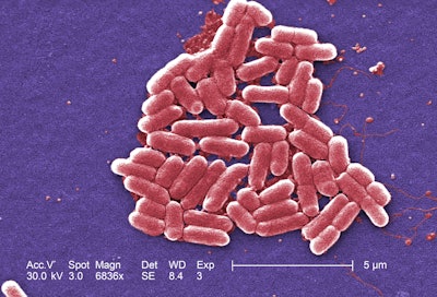 An independent review found the 2012 outbreak of E. coli O157:H7 that led to the largest beef recall in Canadian history was due to a lax approach to food safety on the part of XL Foods. The independent panel also said XL Foods was not prepared to handle a large recall.