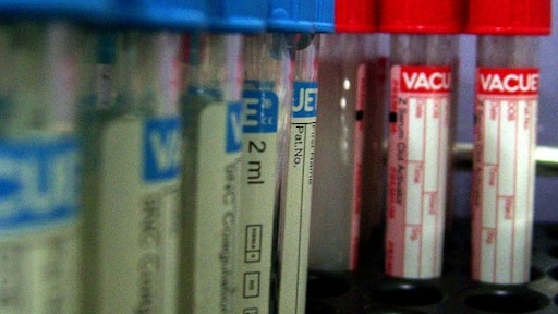 The U.S. Department of Transportation is moving to establish a national database — also known as a clearinghouse — that would list truck drivers who have failed drug and alcohol tests. It would also list drivers who have refused to take them.