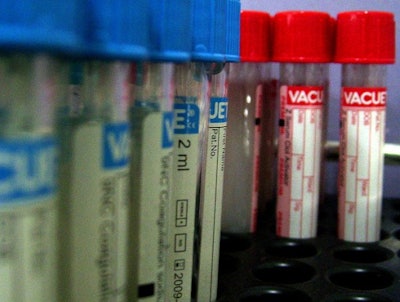 The U.S. Department of Transportation is moving to establish a national database — also known as a clearinghouse — that would list truck drivers who have failed drug and alcohol tests. It would also list drivers who have refused to take them.
