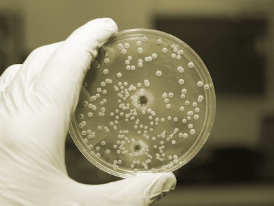 Salmonella testing 57b47acdbc07a