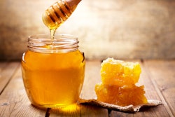 Getty Images 887517012