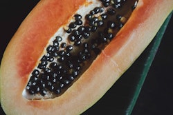 Adrienne Leonard E Dva1 Nb Lk Mm Unsplash